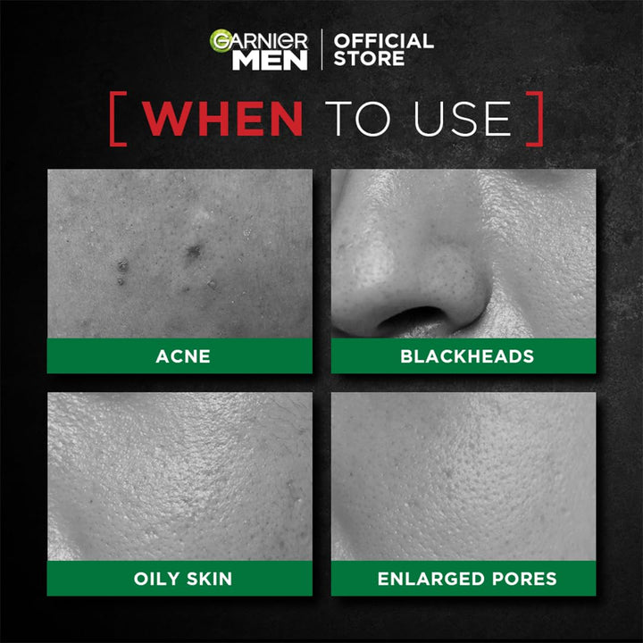 Garnier Men Acno Fight XL Tissue Mask Men, 5X Salicylic Acid and Charcoal Powder, Fight Pimple causing Sebum & Germs in 5 min, 10X absorption power for better absorption of serum, for all Skin types